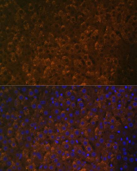UGT1A6 Rabbit polyclonal antibody