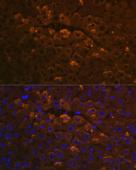 UGT1A6 Rabbit polyclonal antibody