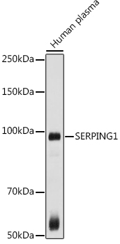 SERPING1 Rabbit pAb