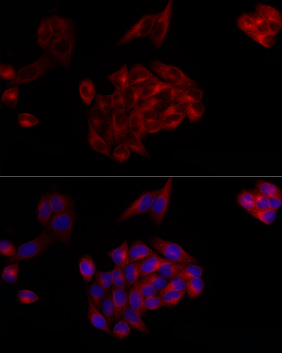 SERPING1 Rabbit polyclonal antibody