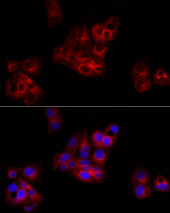 SERPING1 Rabbit polyclonal antibody
