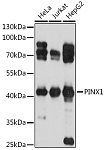 Western blot - PINX1 Rabbit pAb (A17172)