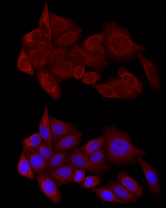 STX17 Rabbit polyclonal antibody