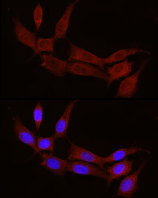 STX17 Rabbit polyclonal antibody