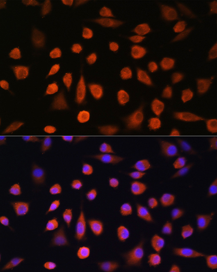 EDEM2 Rabbit polyclonal antibody