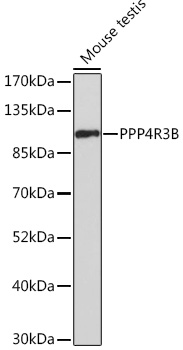 PPP4R3B Rabbit polyclonal antibody