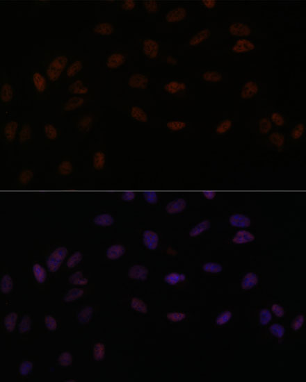 PPP4R3B Rabbit polyclonal antibody