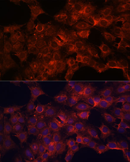 PDP2 Rabbit polyclonal antibody