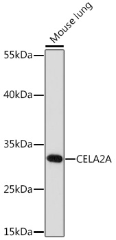CELA2A Rabbit polyclonal antibody