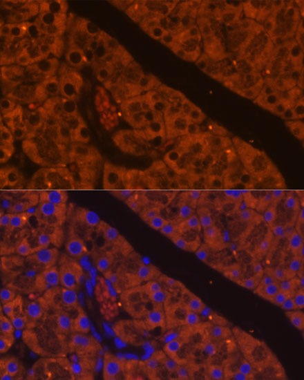 CELA2A Rabbit polyclonal antibody