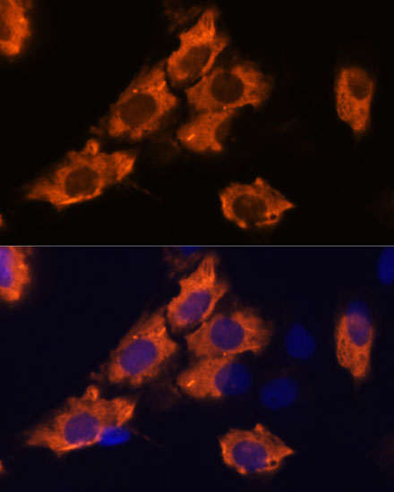 SEMA4A Rabbit polyclonal antibody