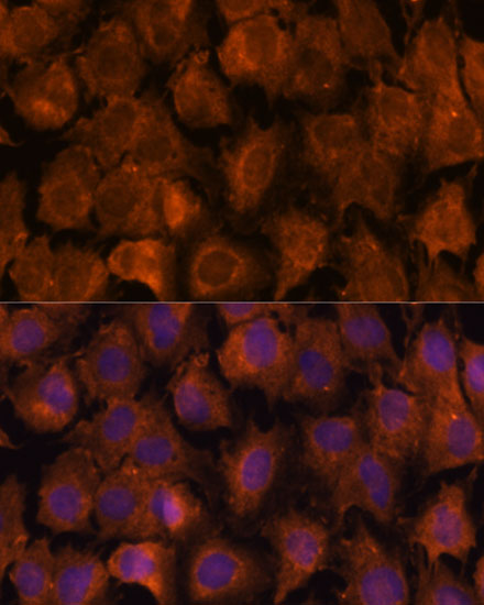 NXN Rabbit polyclonal antibody