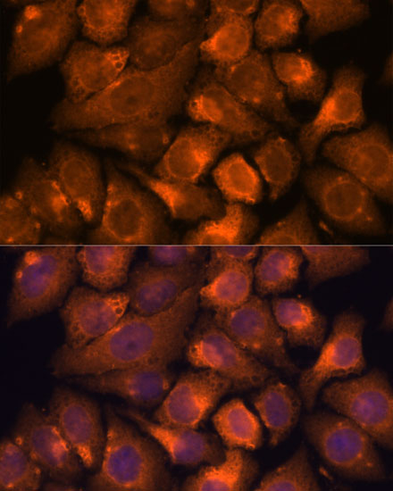 NXN Rabbit polyclonal antibody