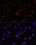 Immunofluorescence - Bcl9 Rabbit pAb (A17209)