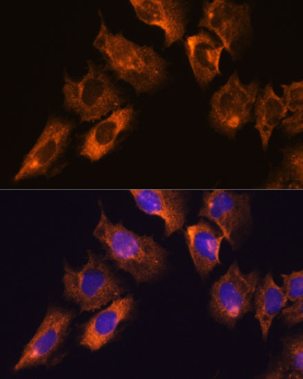 CAMKV Rabbit polyclonal antibody