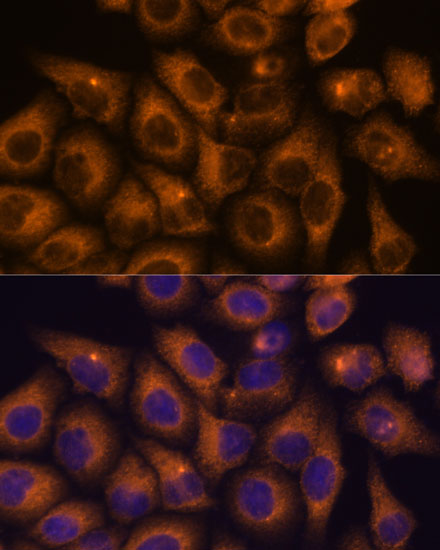 CAMKV Rabbit polyclonal antibody