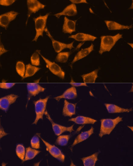 CAMKV Rabbit polyclonal antibody
