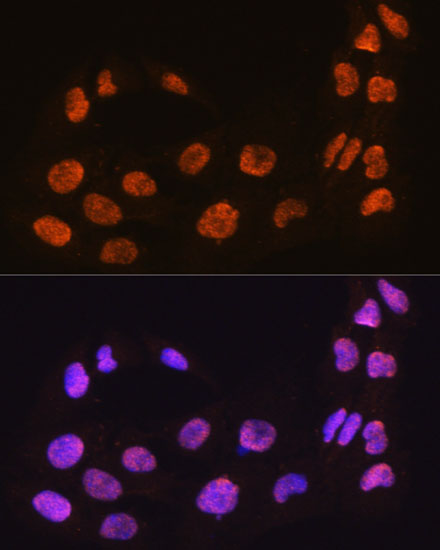 MAML2 Rabbit polyclonal antibody