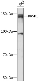 BRSK1 Rabbit polyclonal antibody