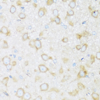 BRSK1 Rabbit polyclonal antibody