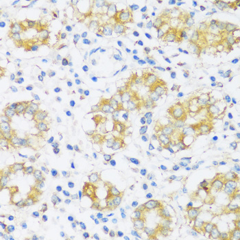 BRSK1 Rabbit polyclonal antibody