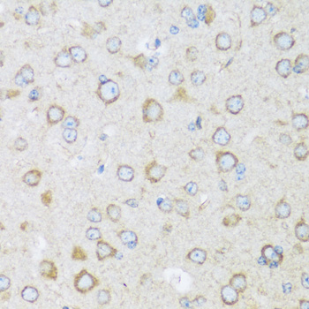 BRSK1 Rabbit polyclonal antibody