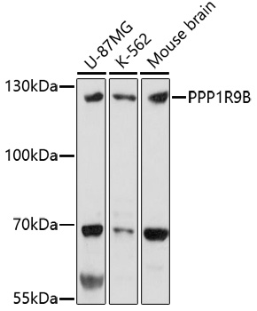 PPP1R9B Rabbit polyclonal antibody