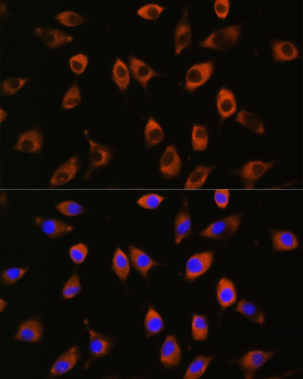 PPP1R9B Rabbit polyclonal antibody