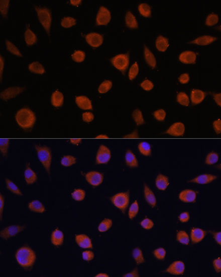 ZCCHC3 Rabbit polyclonal antibody