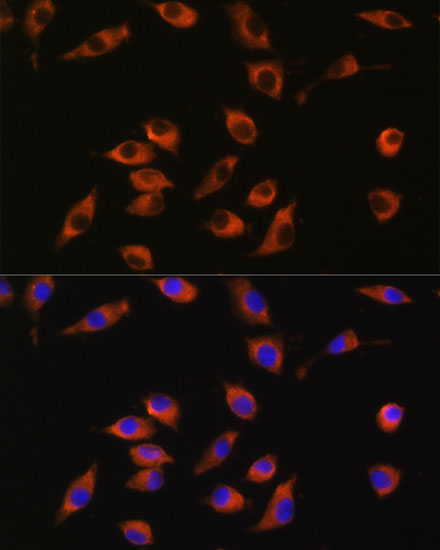 SYT12 Rabbit polyclonal antibody
