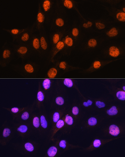 ARX Rabbit polyclonal antibody