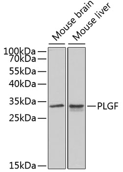 PLGF Rabbit polyclonal antibody