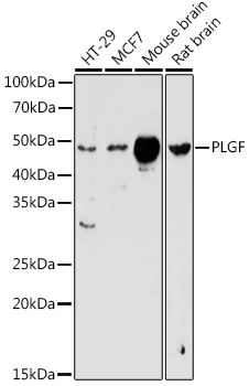 PLGF Rabbit polyclonal antibody