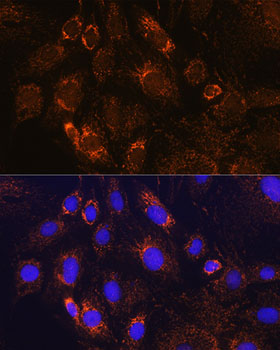 PDE12 Rabbit polyclonal antibody