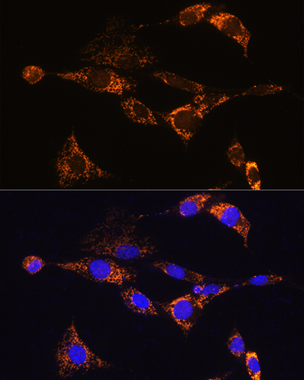 PDE12 Rabbit polyclonal antibody