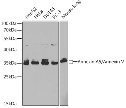 [KO Validated] Annexin A5/Annexin V Rabbit polyclonal antibody