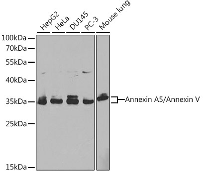 [KO Validated] Annexin A5/Annexin V Rabbit pAb