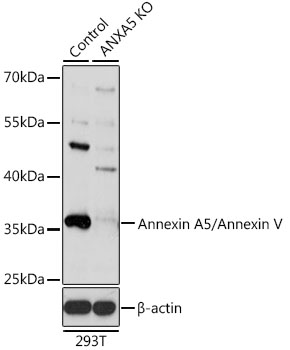 [KO Validated] Annexin A5/Annexin V Rabbit polyclonal antibody