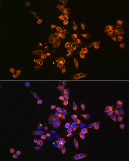 [KO Validated] Annexin A5/Annexin V Rabbit polyclonal antibody
