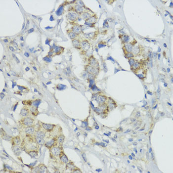 BMPR1B Rabbit polyclonal antibody