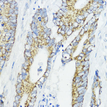 BMPR1B Rabbit polyclonal antibody