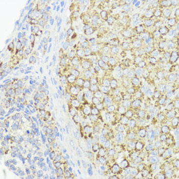 BMPR1B Rabbit polyclonal antibody