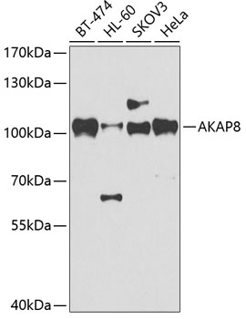 AKAP8 Rabbit polyclonal antibody