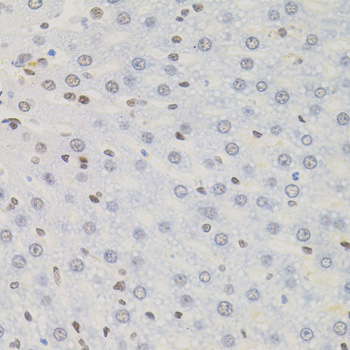 AKAP8 Rabbit polyclonal antibody