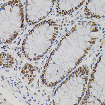 AKAP8 Rabbit polyclonal antibody