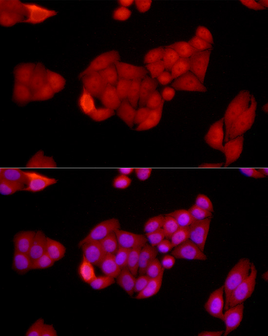 [KO Validated] SIRT1 Rabbit polyclonal antibody