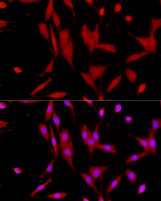 [KO Validated] SIRT1 Rabbit polyclonal antibody