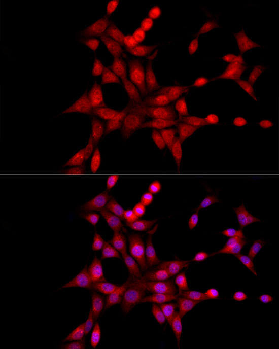 XBP1 Rabbit polyclonal antibody