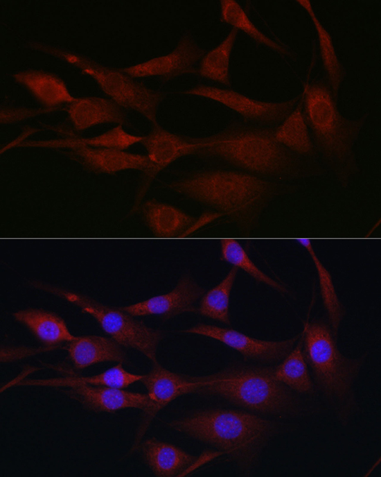 MLKL Rabbit polyclonal antibody