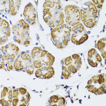 HDAC6 Rabbit polyclonal antibody